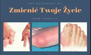 Dna moczanowa: Jaki lekarz pomoże? Skuteczna ścieżka leczenia