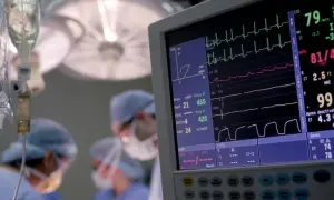 Monitor medyczny pokazuje parametry życiowe pacjenta. W tle widać personel medyczny i kroplówkę. Warto wiedzieć, ile zarabia anestezjolog.