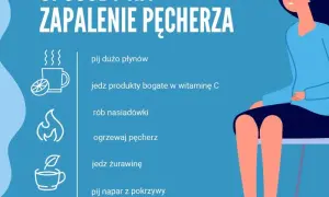 Zapalenie pęcherza bez recepty: Szybka ulga i kiedy do lekarza?