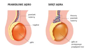 Urolog czy androlog? Kto leczy jądra i kiedy iść do lekarza?