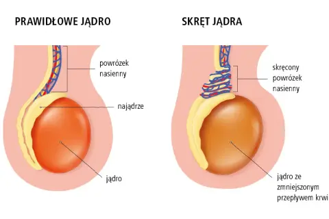 Urolog czy androlog? Kto leczy jądra i kiedy iść do lekarza?