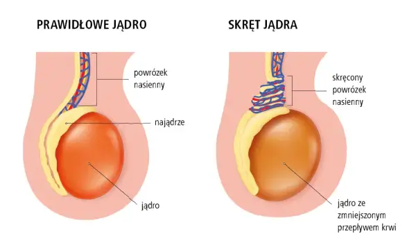 Urolog czy androlog? Kto leczy jądra i kiedy iść do lekarza?